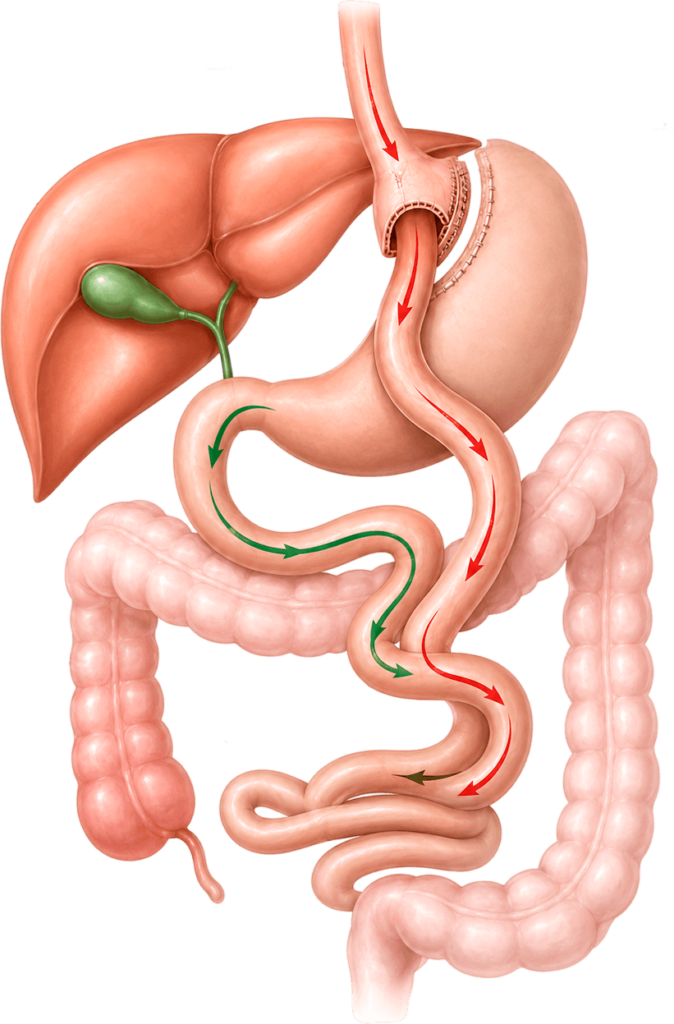 Bypass gastrico 674x1024